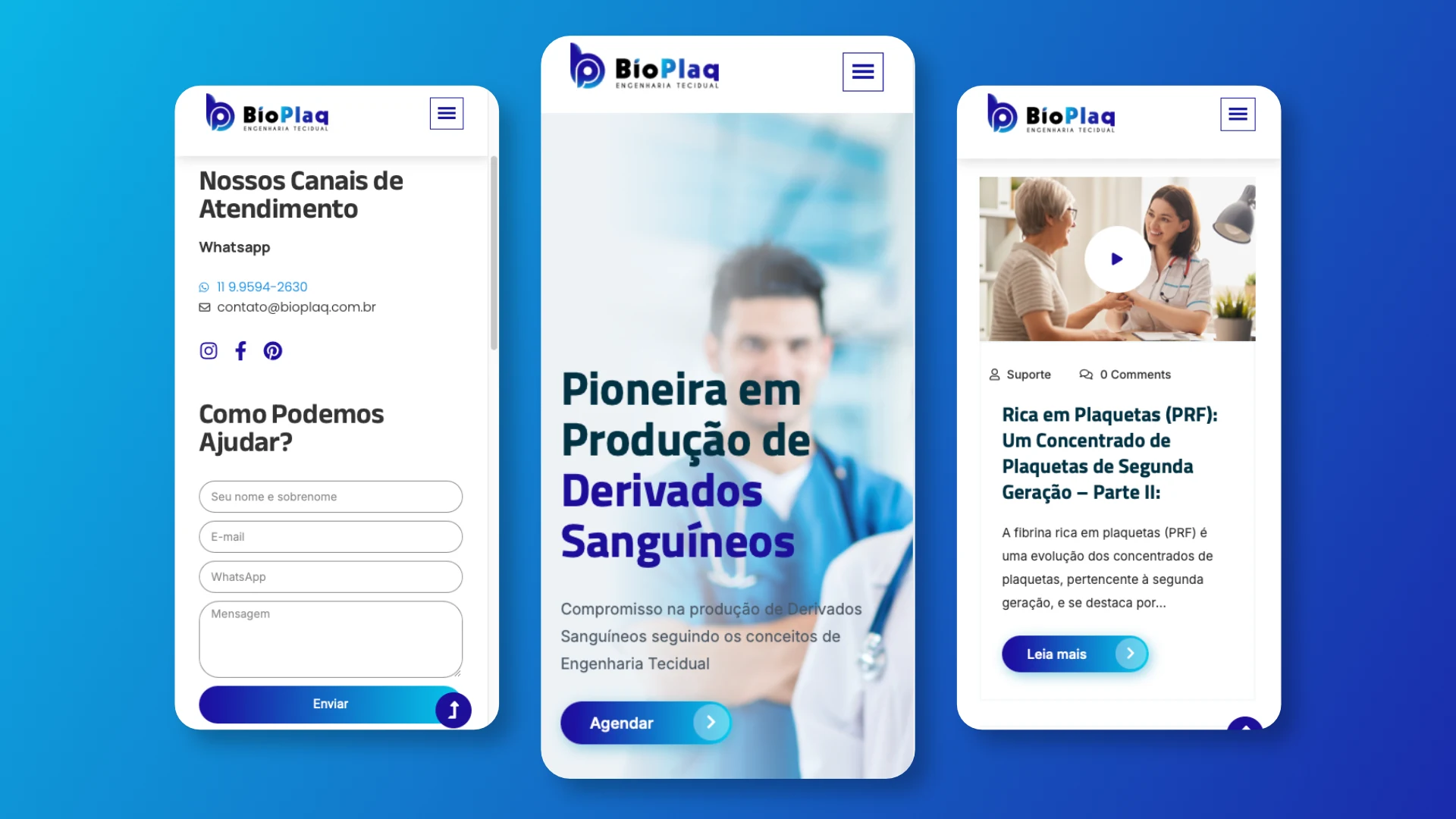 BioPlaq-Engenharia-Tecidual-–-Engenharia-Tecidual-atraves-da-Producao-d-Derivados-Sanguineos_4.webp